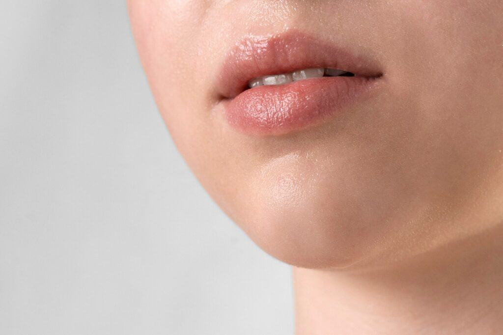 cara mengatasi bibir kering dengan mudah